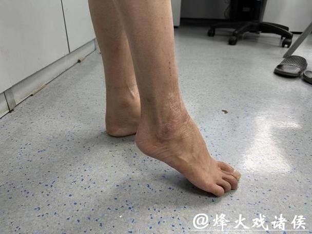 拜仁中场托利索接受脚踝手术